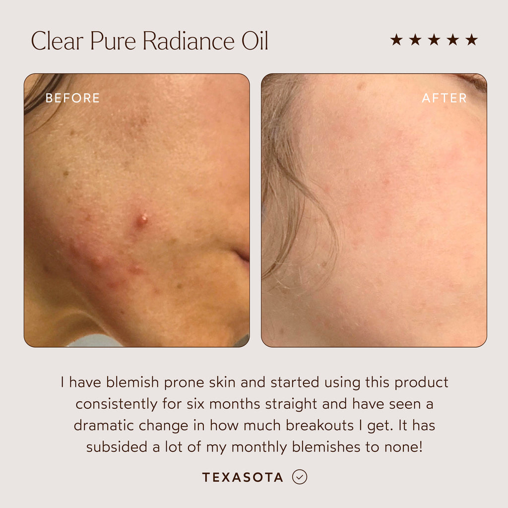 True Botanicals-CLEAR Pure Radiance Oil-Skincare-S-W-D-PRC1-R-3_9df1552a-876d-43dd-8d69-4017a83a6fdc-The Detox Market | 