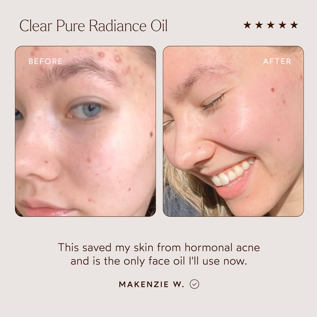 True Botanicals-CLEAR Pure Radiance Oil-Skincare-S-W-D-PRC1-R-4_72118aee-3f27-46d6-8cb7-55c32c0a4983-The Detox Market | 