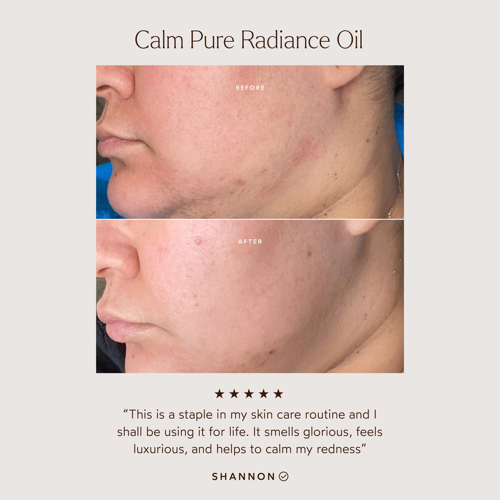 True Botanicals-CALM Pure Radiance Oil-Skincare-S-W-D-PRCM-R-3_81ec7a95-8395-484d-bdd0-1f888f467540-The Detox Market | 