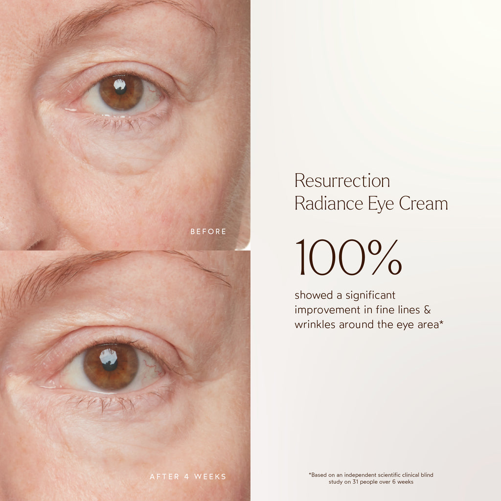 True Botanicals-RENEW Resurrection Radiance Eye Cream-Skincare-S-W-D-RREC-R-3_b5482353-8ed2-48c9-bbea-4371d211c505-The Detox Market | 